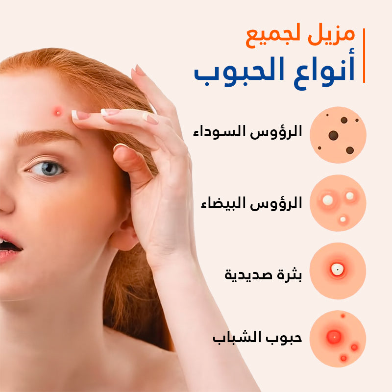 Patchs Hydrocolloïdes - مزيل حبوب