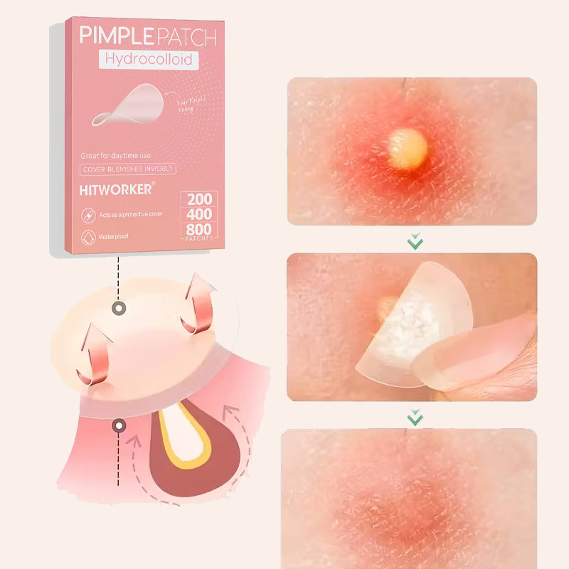 Patchs Hydrocolloïdes - مزيل حبوب